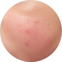 Collection image for: Combination Skin