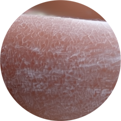 Collection image for: Dry  Skin
