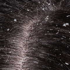 Collection image for: Dry & Itchy Scalp