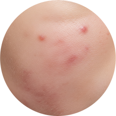 Collection image for: Sensitive Skin