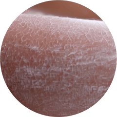 Dry  Skin - Simply Kids