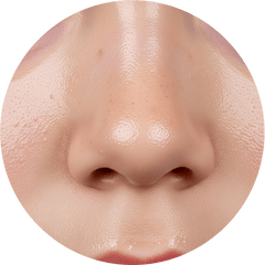 Oily Skin - Simply Kids