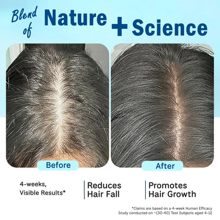 Before and after results of a hair treatment showing reduced hair thinning, healthier scalp, and visibly fuller hair after 4 weeks