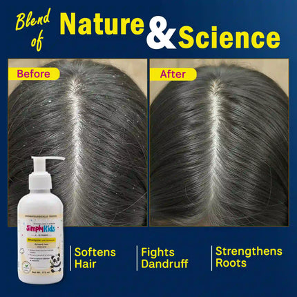 Before and after view of a child’s scalp showing reduced dandruff and healthier hair after using a kids anti-dandruff shampoo that softens hair and strengthens roots